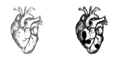healthy/diseased heart side by side